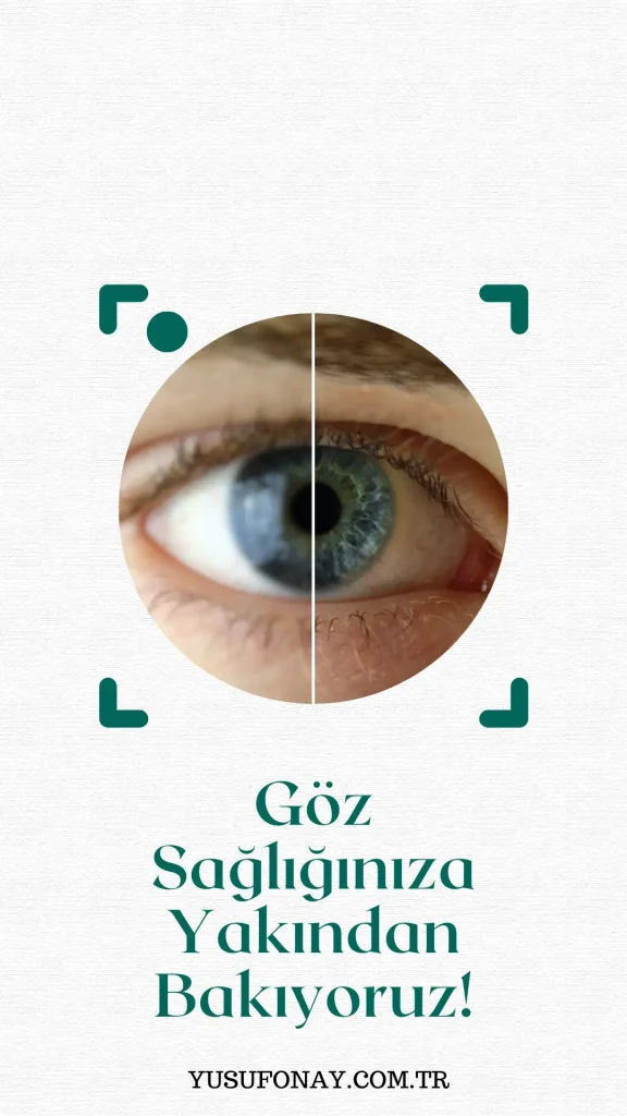 göz sağlığı yusuf onay